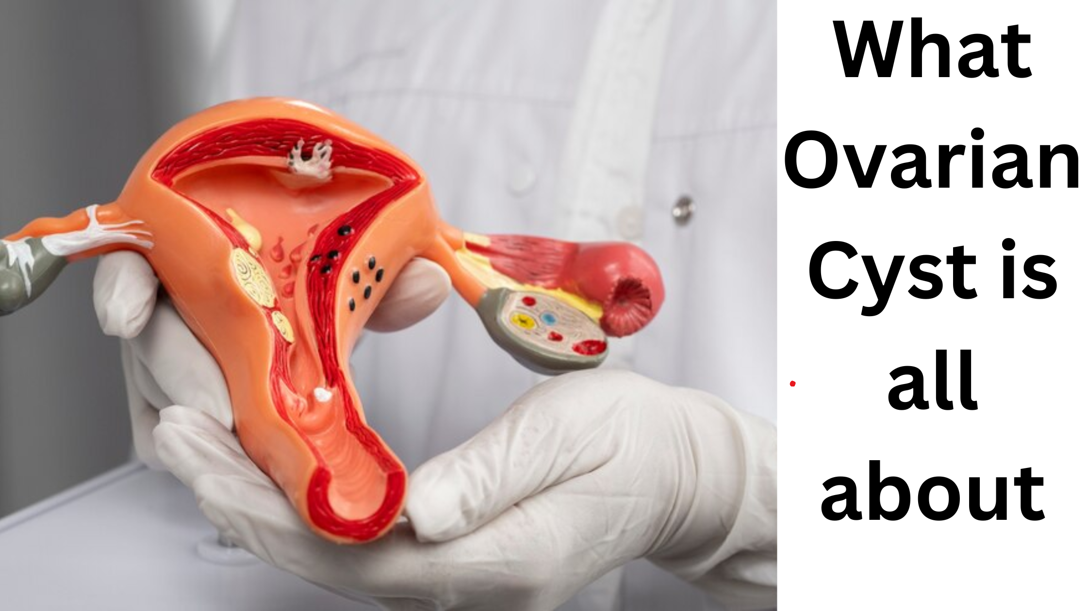 What Ovarian Cyst Is All About